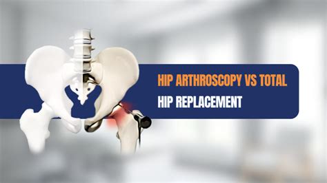 total hip arthroscopy chanel boyer